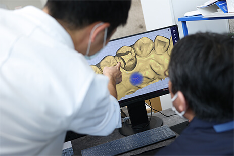 院内ラボでの製作