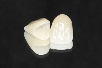 ジルコニアオールセラミック