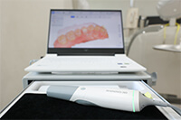 口腔内スキャナーで口腔内の読み取り