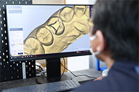 AI設計と歯科技工士による調整